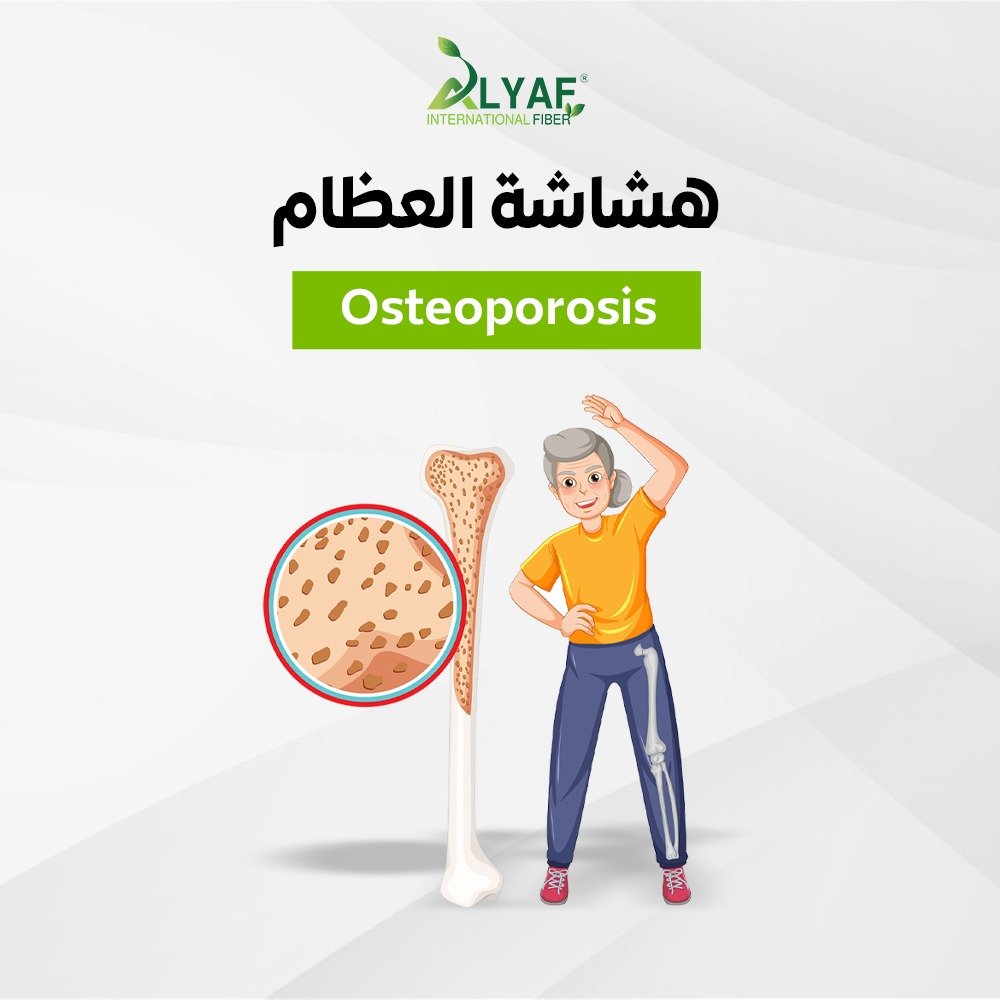 دور التغذية السليمة دعم صحة العظام والمفاصل و الوقاية من الهشاشة